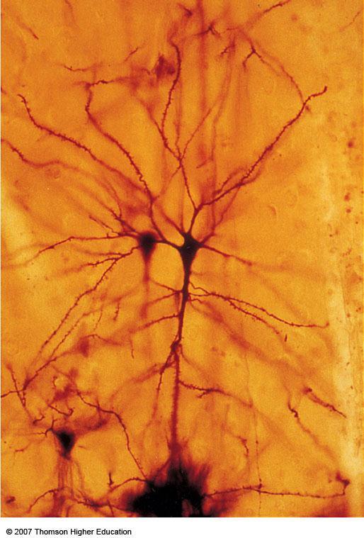 Figure: Neurons, stained to