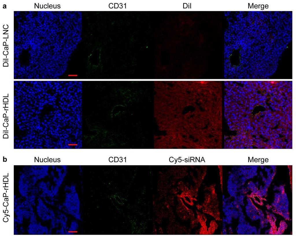 Supplementary Figure 5. Distribution of DiI-CaP-LNC, DiI-CaP-rHDL and Cy5- CaP-rHDL (red) in the glioblastoma sites.