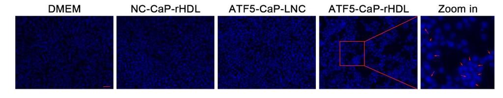 Supplementary Figure 8. ATF5-CaP-rHDL induced apoptosis in C6 cells.