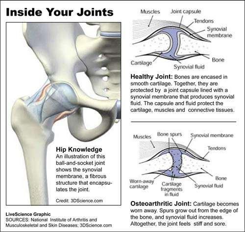 2. Why do old people get sore joints? Healthy joints. Unhealthy joints. 3.