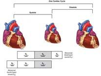 Abnormal heart sounds S 3 and S 4 One cardiac cycle Heart