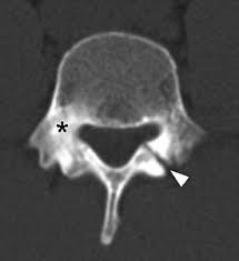 dog ) MRI vs SPECT bone