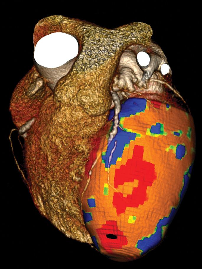 CONTINUING MEDICAL EDUCATION Johns Hopkins University School of Medicine Division of Cardiology Presents: Johns Hopkins Myocardial CT Perfusion Practicum: From