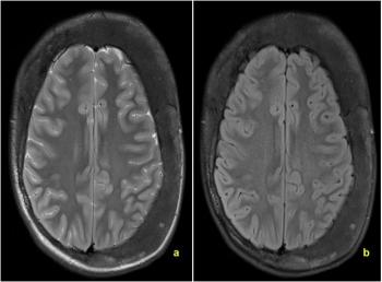 tibia and talus. Imaging Technique: SPECT; Special Focus: Metabolic disorders; Figure 8 Magnetic resonance (MR) of the brain MR of the brain.