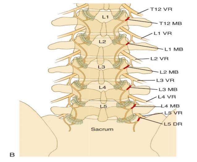 RFA to denervate the lumbar facet joint EBM (Spine Journal 2017): Meta-analysis of 7 randomized