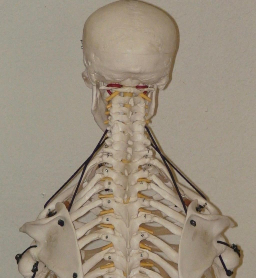 Chapter 21 NECK AND HEAD INJURIES 319 Chapter 21 NECK AND HEAD The neck (cervical vertebrae) is the upper end of the back s vertebral column, on top of the mobile thoracic, and lumbar, and fused
