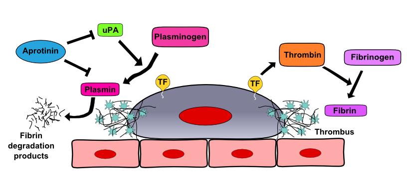 21 Figure 1.3 Interaction between an arrested tumor cell and cell-surface thrombus. An arrested tumor cell may stimulate the formation of a thrombus through expression of TF on the cell surface.