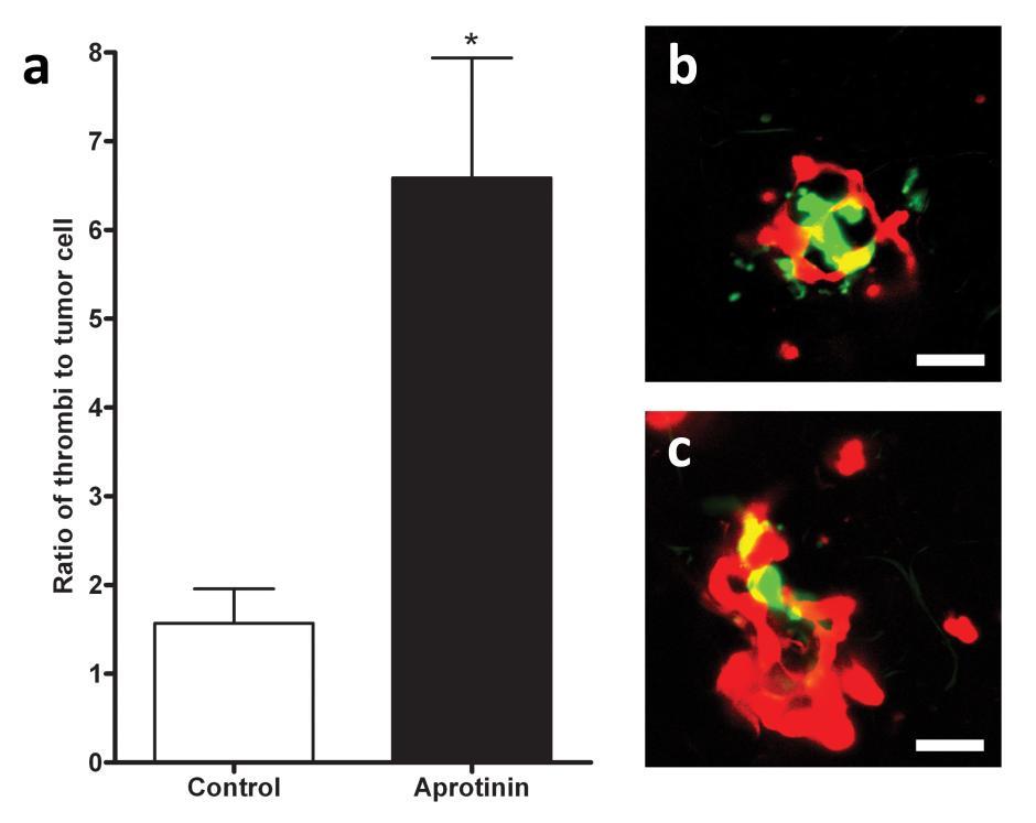 54 Figure 2.5 Aprotinin treatment increased association between B16F10-LacZ cells and fluorescent thrombi.