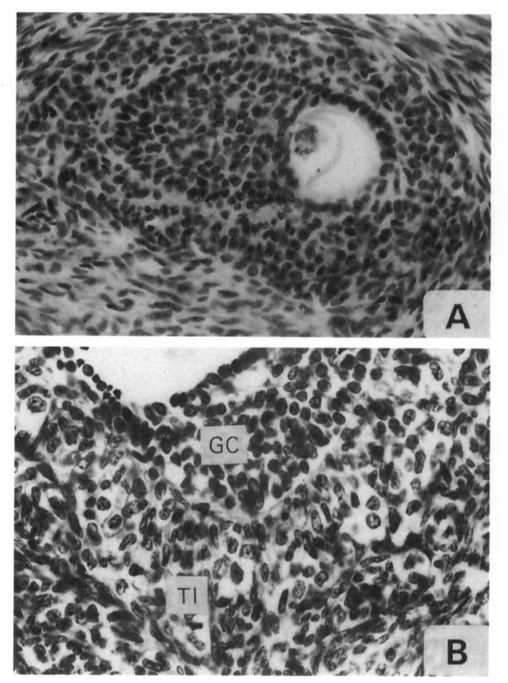 TI has changed into an interstitial gland, and basal lamina is thickened with a thin strip of fibroblasts in its inner part, X30, X320.