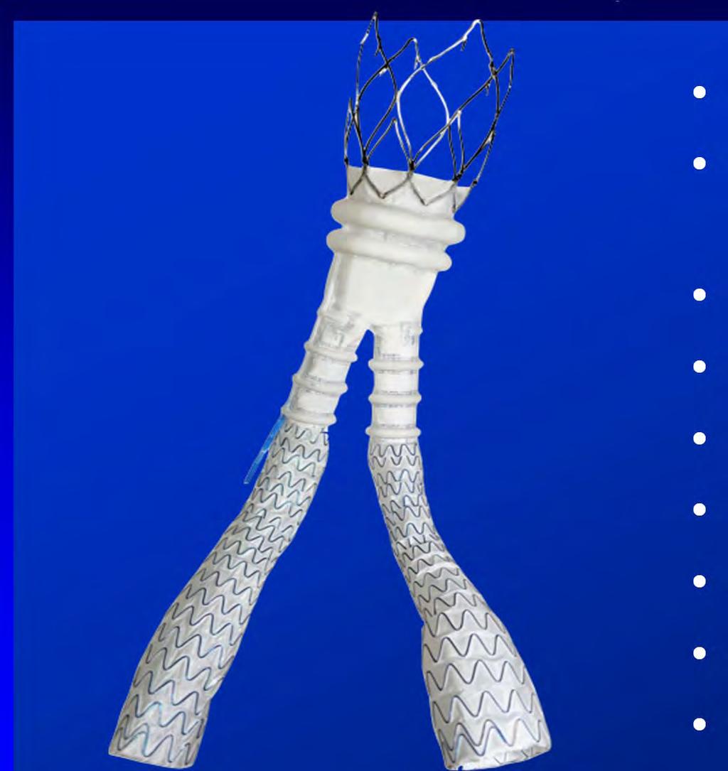 Ovation Abdominal Stent Graft System Tri-modular design Suprarenal stent with anchors for fixation Inflatable rings for optimal seal Low