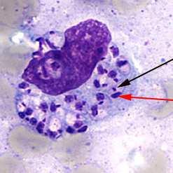 Diagnosis VL: Conventional parasite detection techniques Light-microscopic examination BM a macrophage containing multiple amastigotes nucleus(red arrow) kinetoplast(black arrow) CDC/DPDx