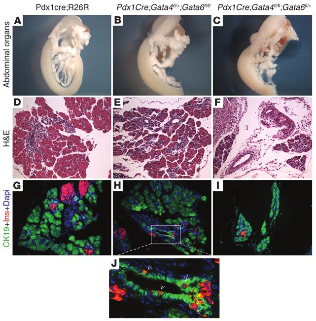 Figure 2 Mice retaining only 1 allele of Gata4 or 1 allele of Gata6 display dissimilar pancreatic defects. Representative E18.