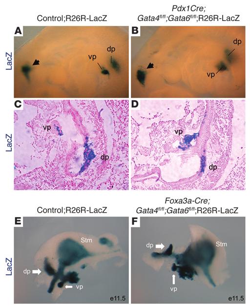 Figure 4 Pancreatic buds are specified in the E9.5 DKO embryos. (A and B) Whole-mount LacZ labeling of Pdx1 progeny in E9.