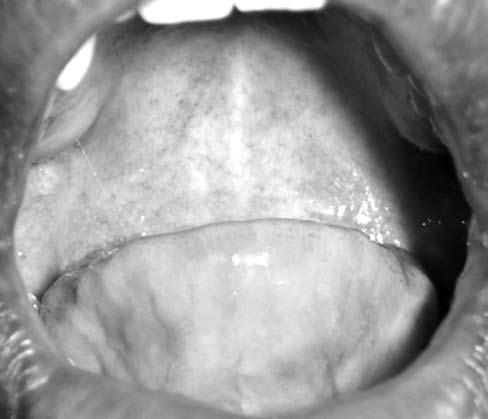 in the oral mucosa decreases the chance of antigen recognition.