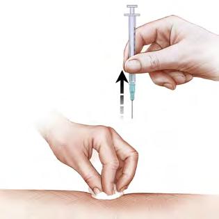 It may be helpful to hold a gauze pad over the injection site and use it to apply pressure once the needle has been removed. Use an ice cube if you feel pain at the injection site.