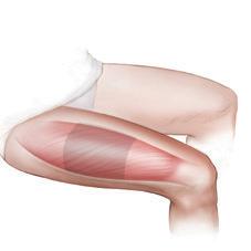 To locate the correct muscle, place your fingertips on the middle of the thigh and gently press down to locate the thigh bone.