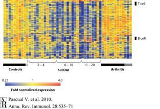 Hierarchical clustering of gene expression in blood leukocytes from healthy children, SLE patients, and juvenile arthritis patients HLA-B27 and