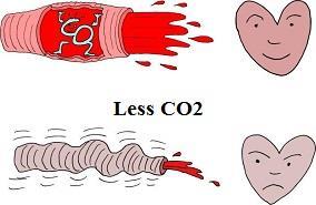 Dioxide Pressure or PCO2 is potent regulator of cerebral arterioles and CBF More CO2 more