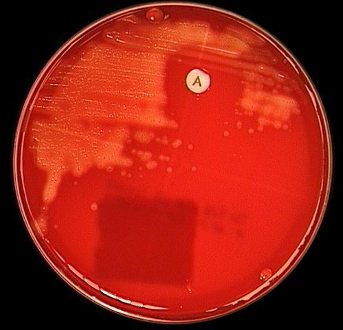 To Differentiate β-haemolytic Streptococci Swab the bacterial suspension on blood agar plate, add a