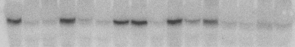 Silencing the Vinv gene by RNAi
