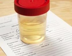 Urine Sample Dilution Dilution results in the drug residue appearing less concentrated in the urine sample.