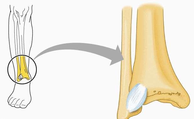 FIBROUS JOINTS ii) SYNDESMOSIS of fibrous joint - Unites bones with a sheet of