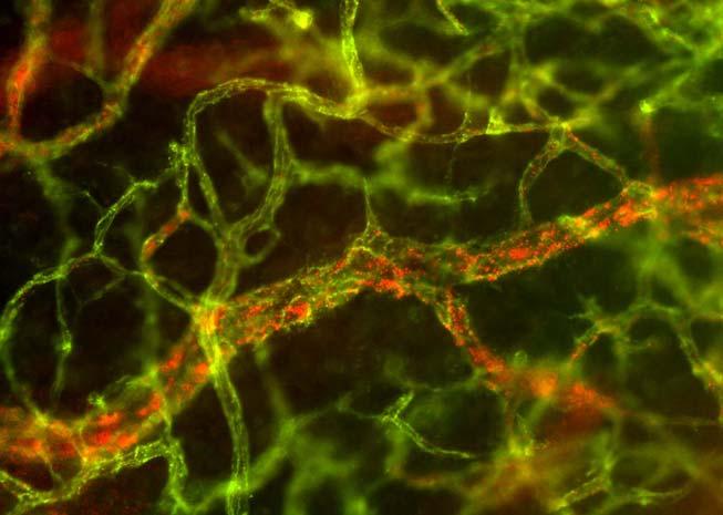 neovasculature htnf TNF-Receptor Endothelium marker (green) + NGR (red) Doses of 0.