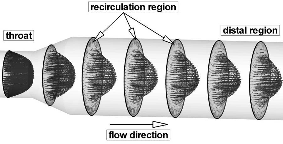 Data Management and Security 215 Figure 4: Velocity vector distribution in different cross sections in distal part of the re-stenosed RCA artery. 3.