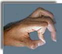 Pain Distribution de Quervain s Disease Pain along the back of the thumb, directly over two thumb tendons
