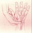 Ganglia of Wrist Ganglionic Cysts of