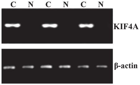 The results of the RT qpcr and western blot analysis revealed almost no expression of KIF4A in the paracancerous tissues, however significantly higher expression levels of KIF4A were observed in