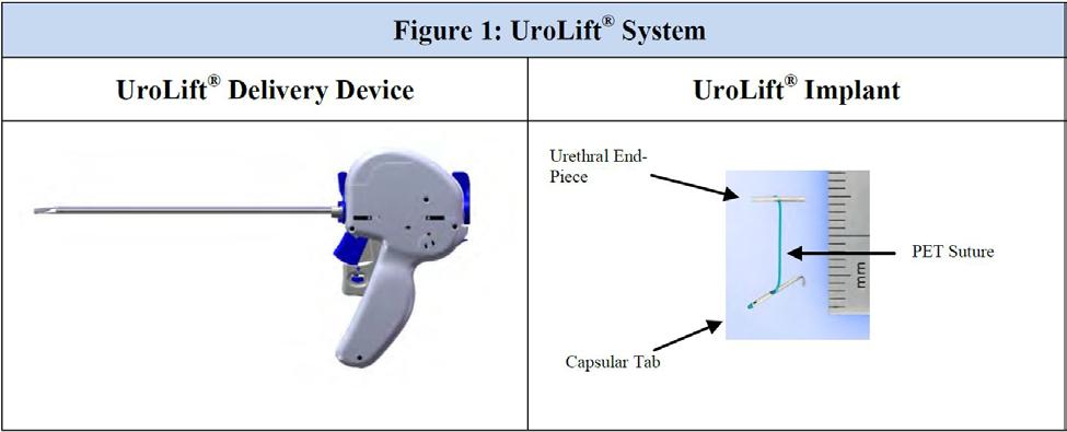 Neotract - UroLift FDA originally cleared 2013, updated clearance in Dec 2017 for treatment of