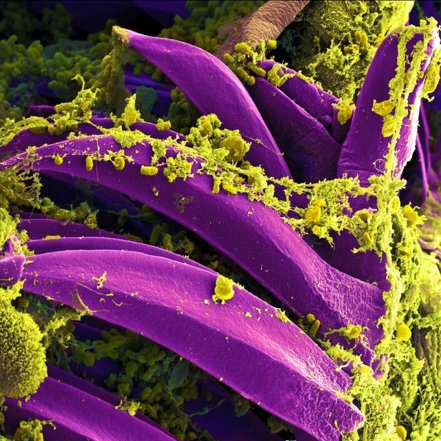 Tiny and very dangerous, the pill shapes among the yellow-green goo are Yersinia pestis, the bacteria that cause the bubonic plague.