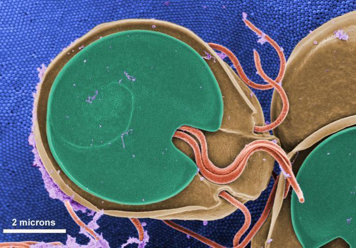 This one-celled microbe is a real pest. Giardia can get into your gut if you drink contaminated water and cause a disease called giardiasis. The major symptom is diarrhea. Ugh.