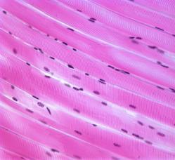 striated, long and round, multiple nuclei per cell