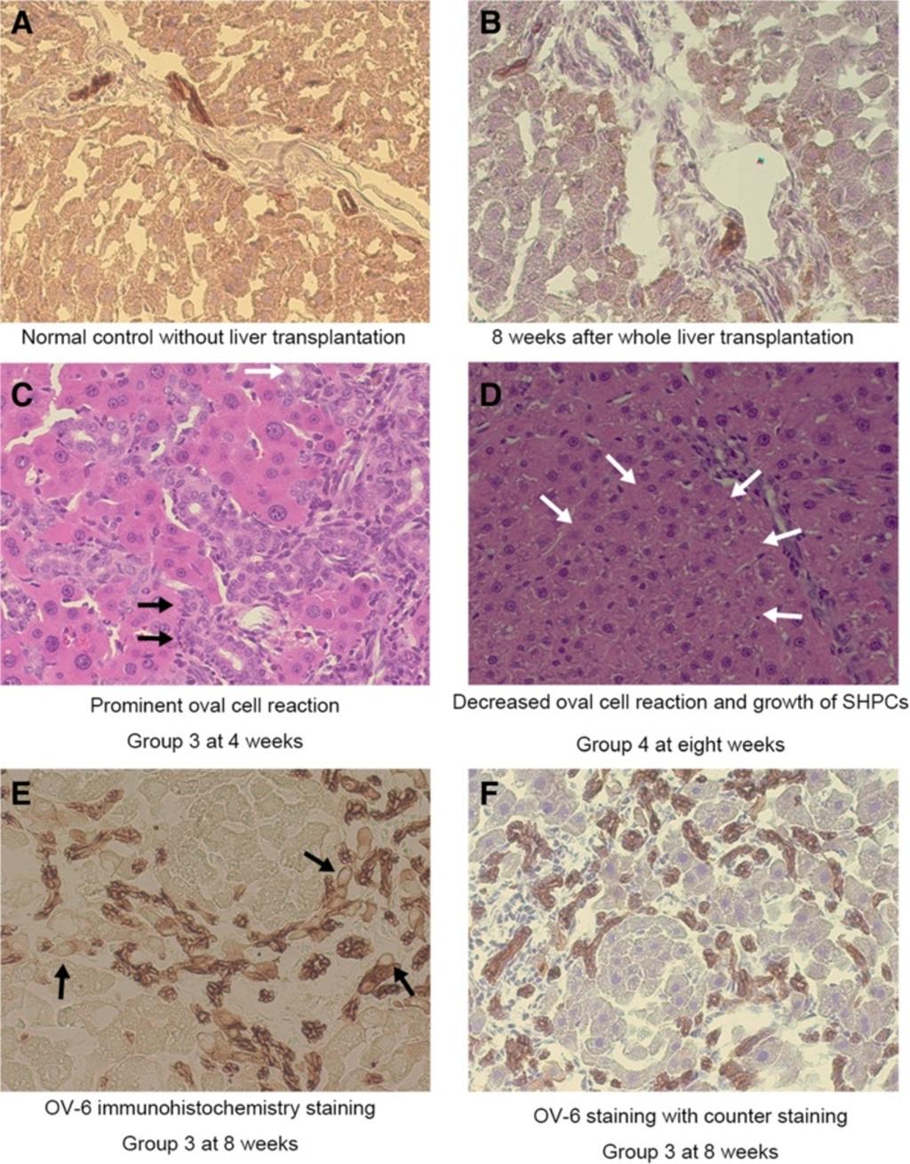Maeda et al. SpringerPlus 2013, 2:446 Page 10 of 11 Figure 7 Evaluation of ductular reaction after LT. (A), (B), (E)&(F) OV-6 immunohistochemistry staining.