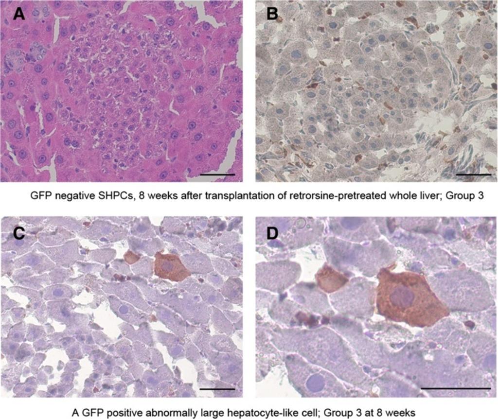 Maeda et al. SpringerPlus 2013, 2:446 Page 6 of 11 Figure 3 Pathological features of retrorsine-pretreated liver after LT and GFP positive hepatocyte-like cells.
