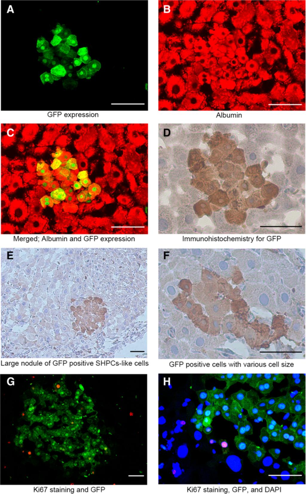 Maeda et al. SpringerPlus 2013, 2:446 Page 7 of 11 Figure 4 Clusters of GFP positive SHPCs-like cells in retrorsine-pretreated liver.