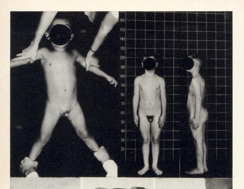 Forced Medical Display + Genital Exams John Money, 1969 Today they probably would make a boy out of me, which might have been even worse, with complications and even more surgeries.