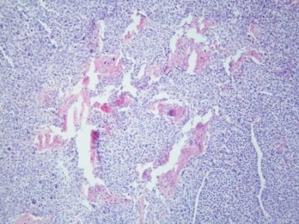 p53-null mice developed hemangiosarcoma,