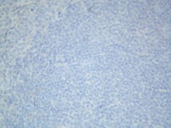 Fig S7 Q/- Normal tissues Q/-