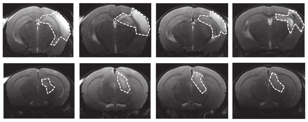 (c) Representative images of ADC maps brain slices after h from H/I mice treated with 1 g of (n=)oranti- (n=).