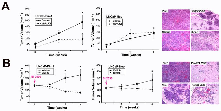 shplk1; shrna targeting PLK1, shcontrol: control shrna. Figure 2. Targeting PLK1 inhibits tumor progression in Pim1 overexpressing prostate tumors.
