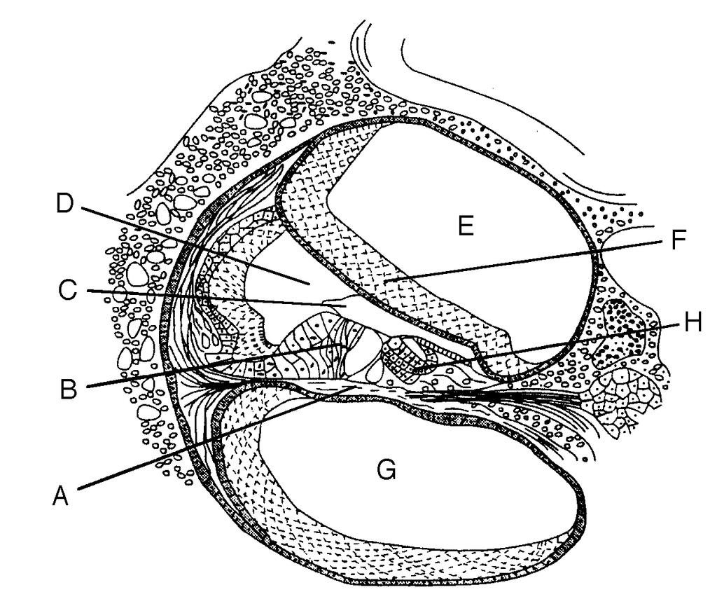 10. Use the figure above to label the parts of the inner ear shown below: Outer Hair Cells Tympanic Canal Inner Hair Cells Cochlear Duct Reissner s Membrane Vestibular Canal Basilar Membrane