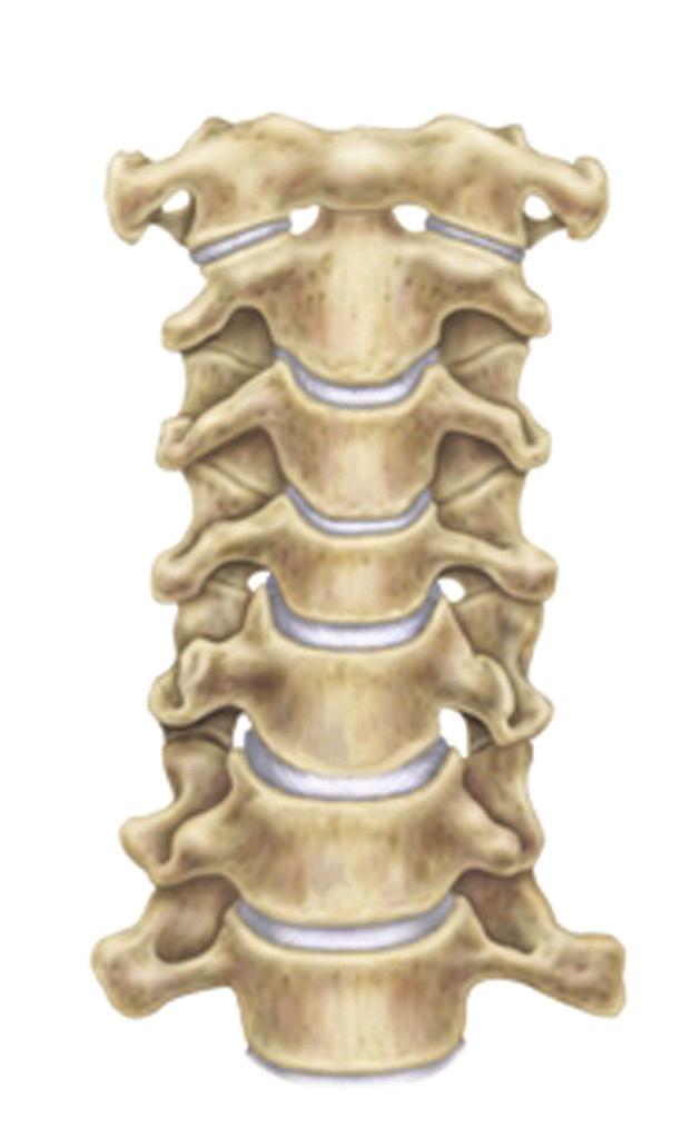 The disk between each of these bones is made of a thick outer lining, which contains the softer central core of the disk.