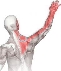 Neck Arthritis Patients typically complain of a stiff neck and pain that worsens when upright.