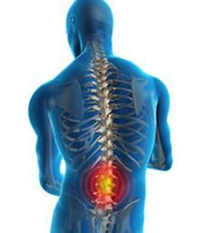 Low Back Pain Low back strain or lumbar strain most common cause of lost work time and disability in adults younger than 45