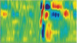 amplitude ( mv/mm ) 2 amplitude ( mv/mm ) 2 Corresponding Effects in Auditory Cortex Cortical Layers 1 vis stim