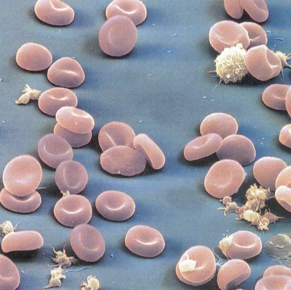 ERYTHROCYTES ~ 2 microns thick ~ 7 microns across Disc shaped Concave on each side Mature