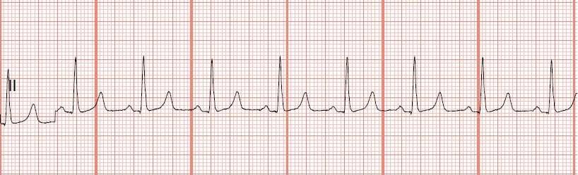 Atrial Rate Vent. Rate Reg Irreg PRI QRS 2. Based on Mrs. Wong s assessment data, what are nurse Bob s three priority interventions?